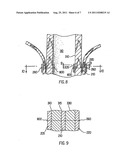 METHOD AND APPARATUS FOR ENDOSCOPIC REPAIR OF THE LOWER ESOPHAGEAL     SPHINCTER diagram and image