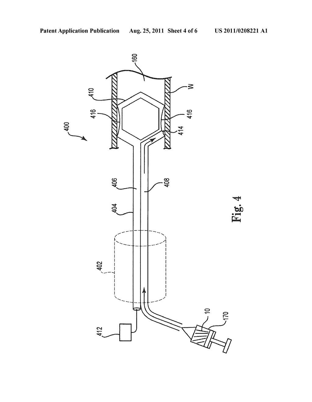 THERAPEUTIC AGENT DELIVERY SYSTEM, DEVICE AND METHOD FOR LOCALIZED     APPLICATION OF THERAPEUTIC SUBSTANCES TO A BIOLOGICAL CONDUIT - diagram, schematic, and image 05