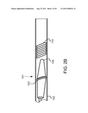 System and Method for the Treatment of Occluded Vessels diagram and image