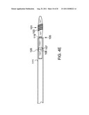 System and Method for the Treatment of Occluded Vessels diagram and image