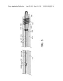 System and Method for the Treatment of Occluded Vessels diagram and image