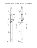 System and Method for the Treatment of Occluded Vessels diagram and image