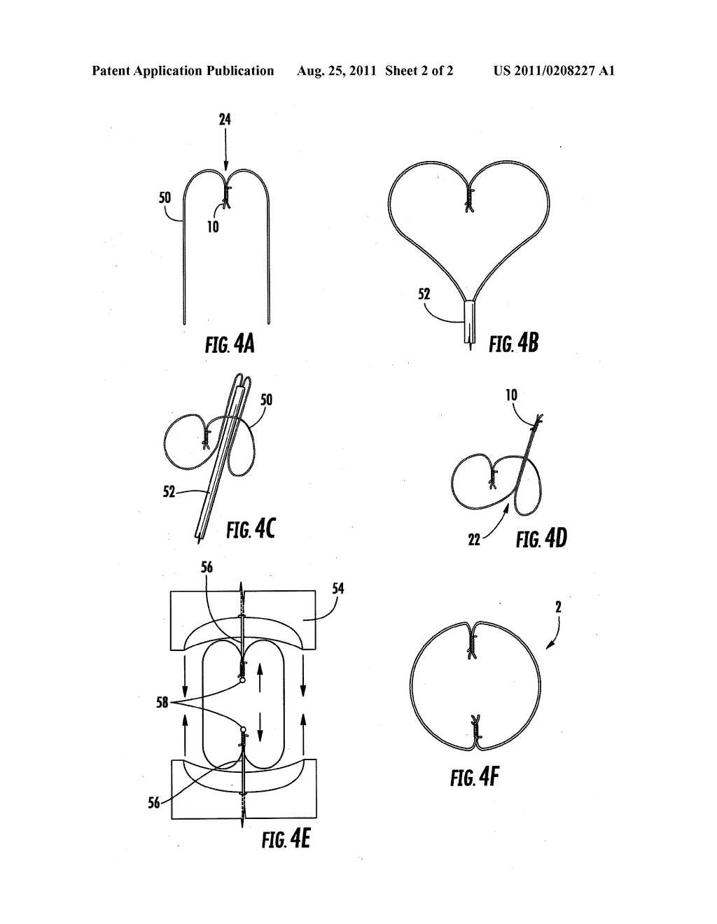 Filamentary Devices For Treatment Of Vascular Defects - diagram, schematic, and image 03