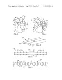 Method and Apparatus for Soft Tissue Fixation diagram and image