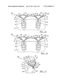 Method and Apparatus for Soft Tissue Fixation diagram and image