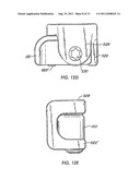 Arthroplasy Revision System and Method diagram and image