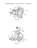 Arthroplasy Revision System and Method diagram and image