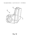 Spinal Facet Implant with Spherical Implant Apposition Surface and Bone     Bed and Methods of Use diagram and image