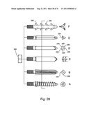 Spinal Facet Implant with Spherical Implant Apposition Surface and Bone     Bed and Methods of Use diagram and image