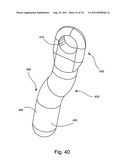 Spinal Facet Implant with Spherical Implant Apposition Surface and Bone     Bed and Methods of Use diagram and image