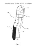 Spinal Facet Implant with Spherical Implant Apposition Surface and Bone     Bed and Methods of Use diagram and image