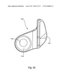 Spinal Facet Implant with Spherical Implant Apposition Surface and Bone     Bed and Methods of Use diagram and image