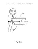 Spinal Facet Implant with Spherical Implant Apposition Surface and Bone     Bed and Methods of Use diagram and image