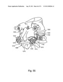 Spinal Facet Implant with Spherical Implant Apposition Surface and Bone     Bed and Methods of Use diagram and image