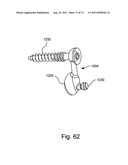 Spinal Facet Implant with Spherical Implant Apposition Surface and Bone     Bed and Methods of Use diagram and image