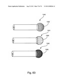 Spinal Facet Implant with Spherical Implant Apposition Surface and Bone     Bed and Methods of Use diagram and image