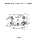 Spinal Facet Implant with Spherical Implant Apposition Surface and Bone     Bed and Methods of Use diagram and image