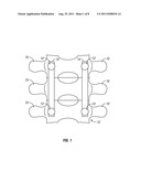 MINIMALLY INVASIVE METHOD AND INSTRUMENT FOR THE REDUCTION OF A ROD INTO     POSITION IN A PEDICLE SCREW diagram and image