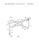 MINIMALLY INVASIVE METHOD AND INSTRUMENT FOR THE REDUCTION OF A ROD INTO     POSITION IN A PEDICLE SCREW diagram and image