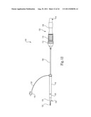 Catheter Assembly with Valve Crimping Accessories diagram and image