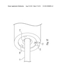 Catheter Assembly with Valve Crimping Accessories diagram and image