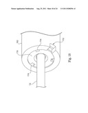 Catheter Assembly with Valve Crimping Accessories diagram and image