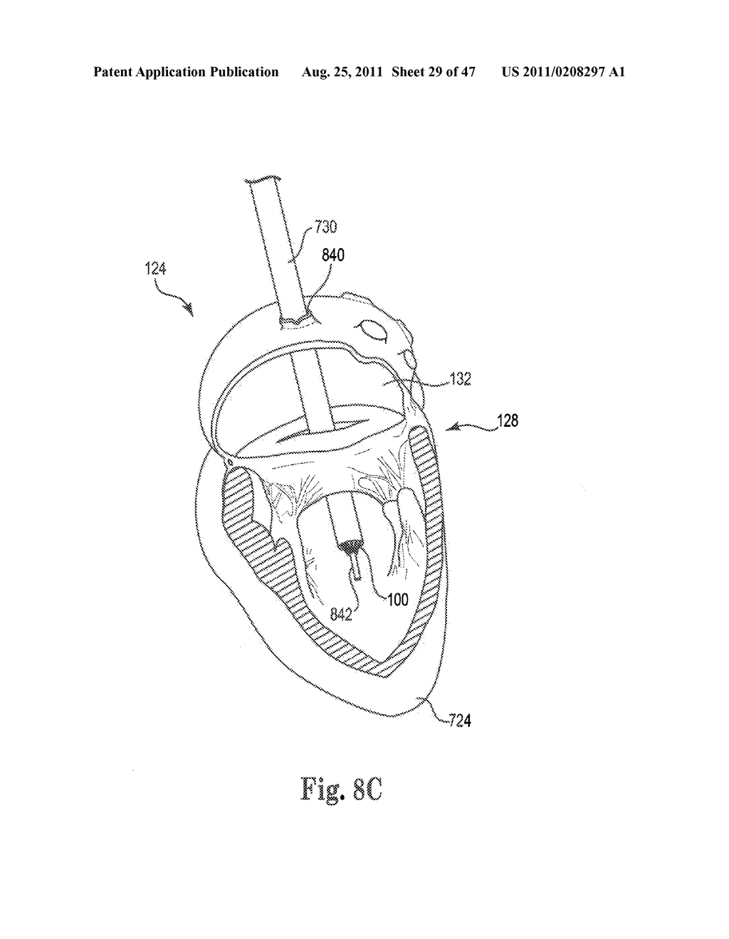 Mitral Prosthesis and Methods for Implantation - diagram, schematic, and image 30