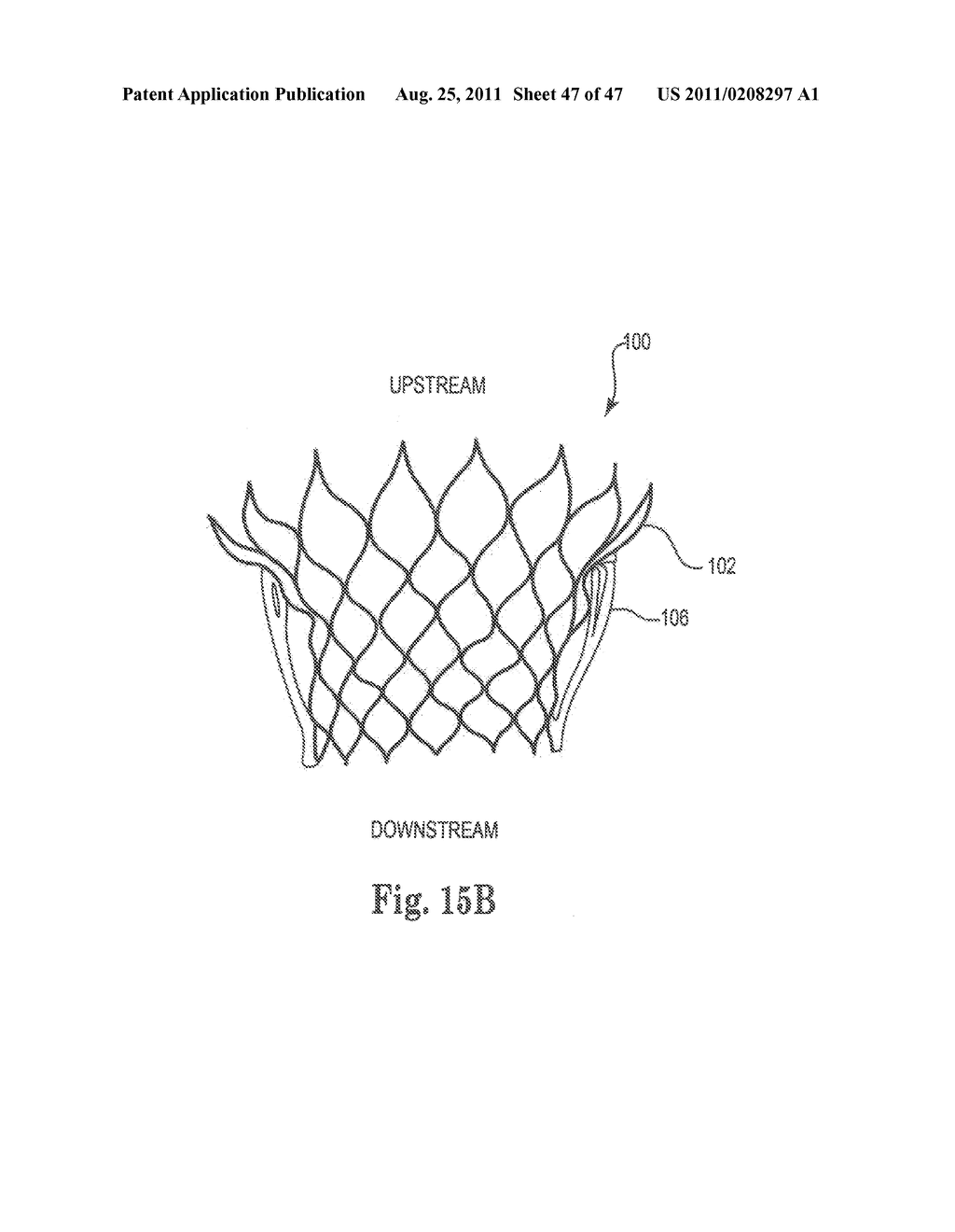 Mitral Prosthesis and Methods for Implantation - diagram, schematic, and image 48