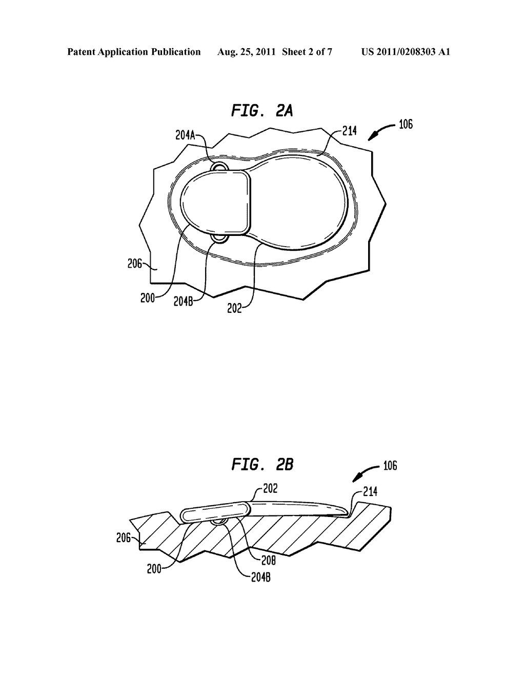 IMPLANTABLE DEVICE HAVING OSSEOINTEGRATING PROTUBERANCES - diagram, schematic, and image 03