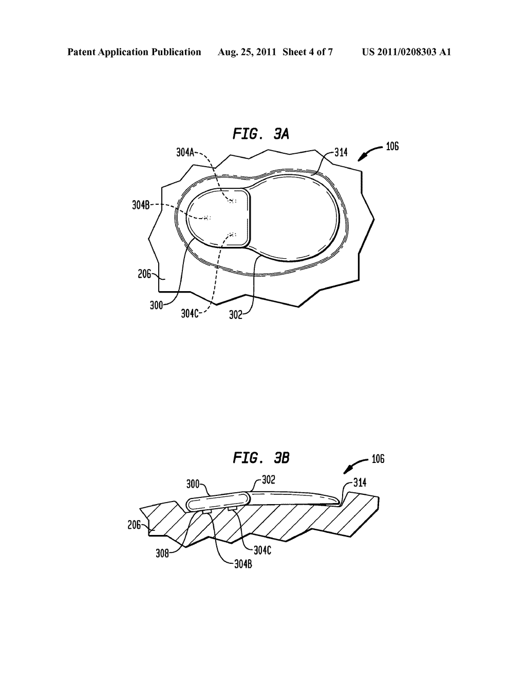 IMPLANTABLE DEVICE HAVING OSSEOINTEGRATING PROTUBERANCES - diagram, schematic, and image 05