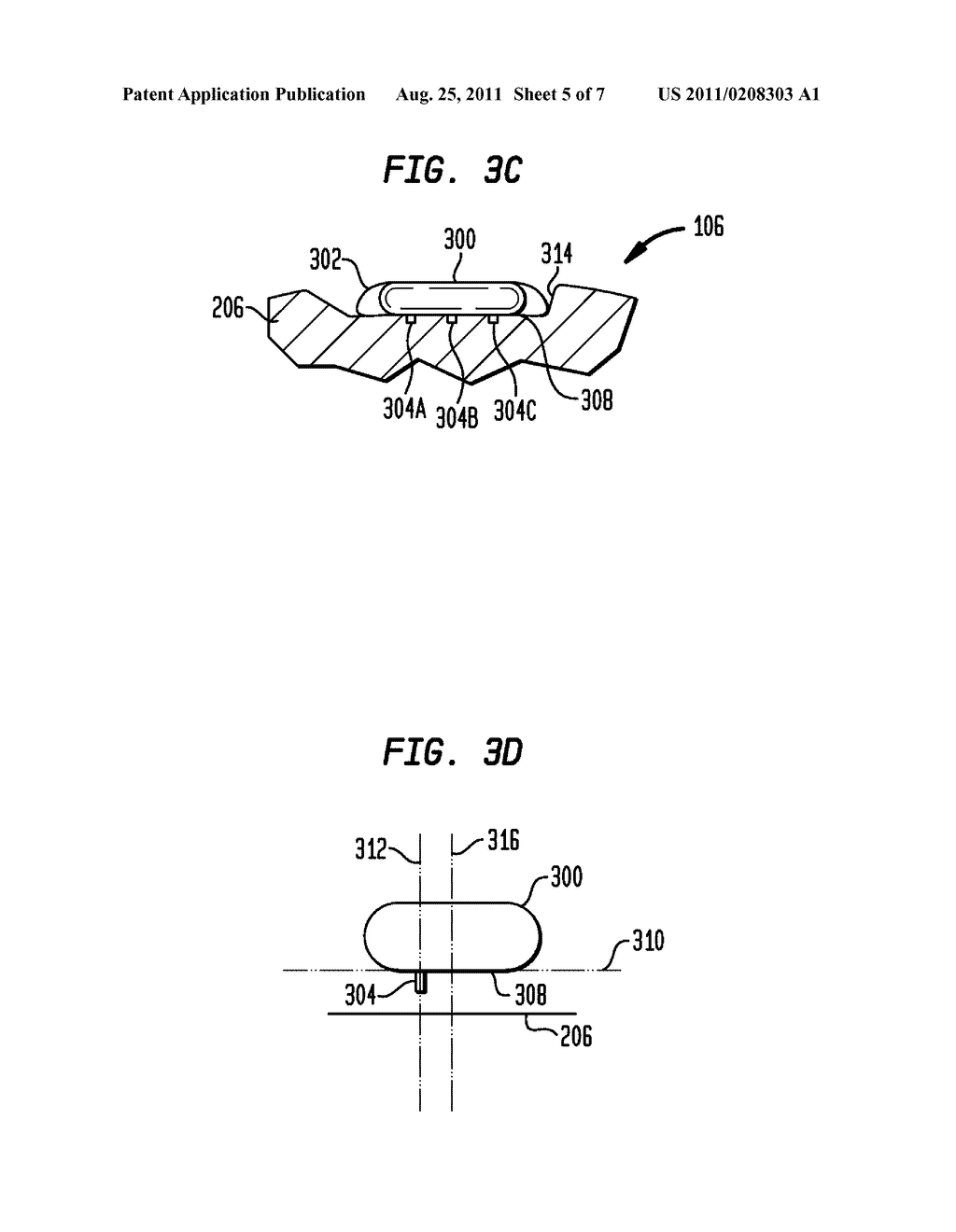 IMPLANTABLE DEVICE HAVING OSSEOINTEGRATING PROTUBERANCES - diagram, schematic, and image 06