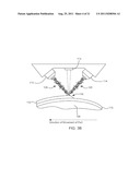 Laser Based Metal Deposition LBMD of Antimicrobials to Implant Surfaces diagram and image