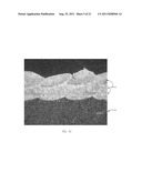 Laser Based Metal Deposition LBMD of Antimicrobials to Implant Surfaces diagram and image