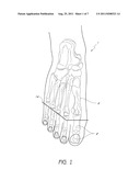 METATARSAL JOINT SHAPE FOR PROSTHETIC FOOT AND CONTROL MECHANISM AND     SYSTEM FOR SAME diagram and image