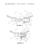 Securing Apparatus and Method diagram and image