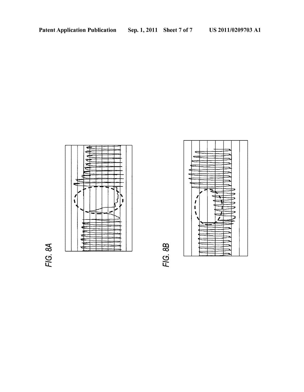 ARTIFICIAL VENTILATION APPARATUS - diagram, schematic, and image 08