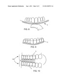 TOOTH COVER DEVICE FOR USE DURING ORAL SEX diagram and image