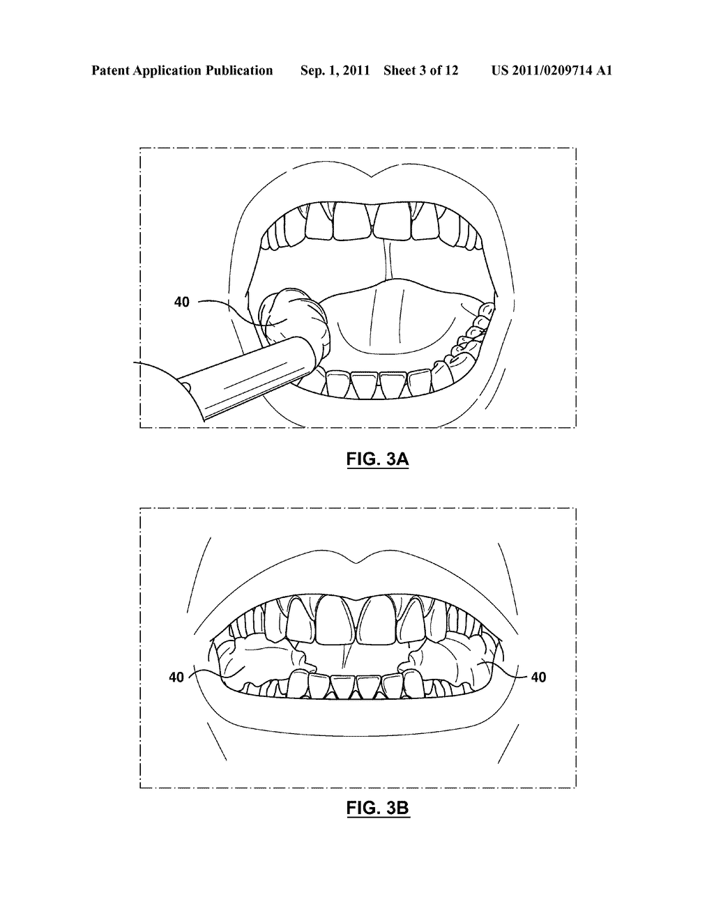 METHODS OF PREPARING CUSTOMIZED MOUTHPIECES FOR ENHANCING ATHLETIC     PERFORMANCE - diagram, schematic, and image 04