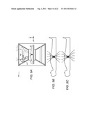 Gantry Image Guided Radiotherapy System And Related Treatment Delivery     Methods diagram and image