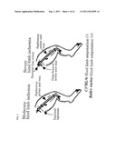 PARAMYXOVIRUS VECTOR ENCODING ANGIOGENESIS GENE AND USE THEREOF diagram and image