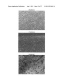 METHODS OF MANUFACTURE OF IMMUNOCOMPATIBLE CHORIONIC MEMBRANE PRODUCTS diagram and image