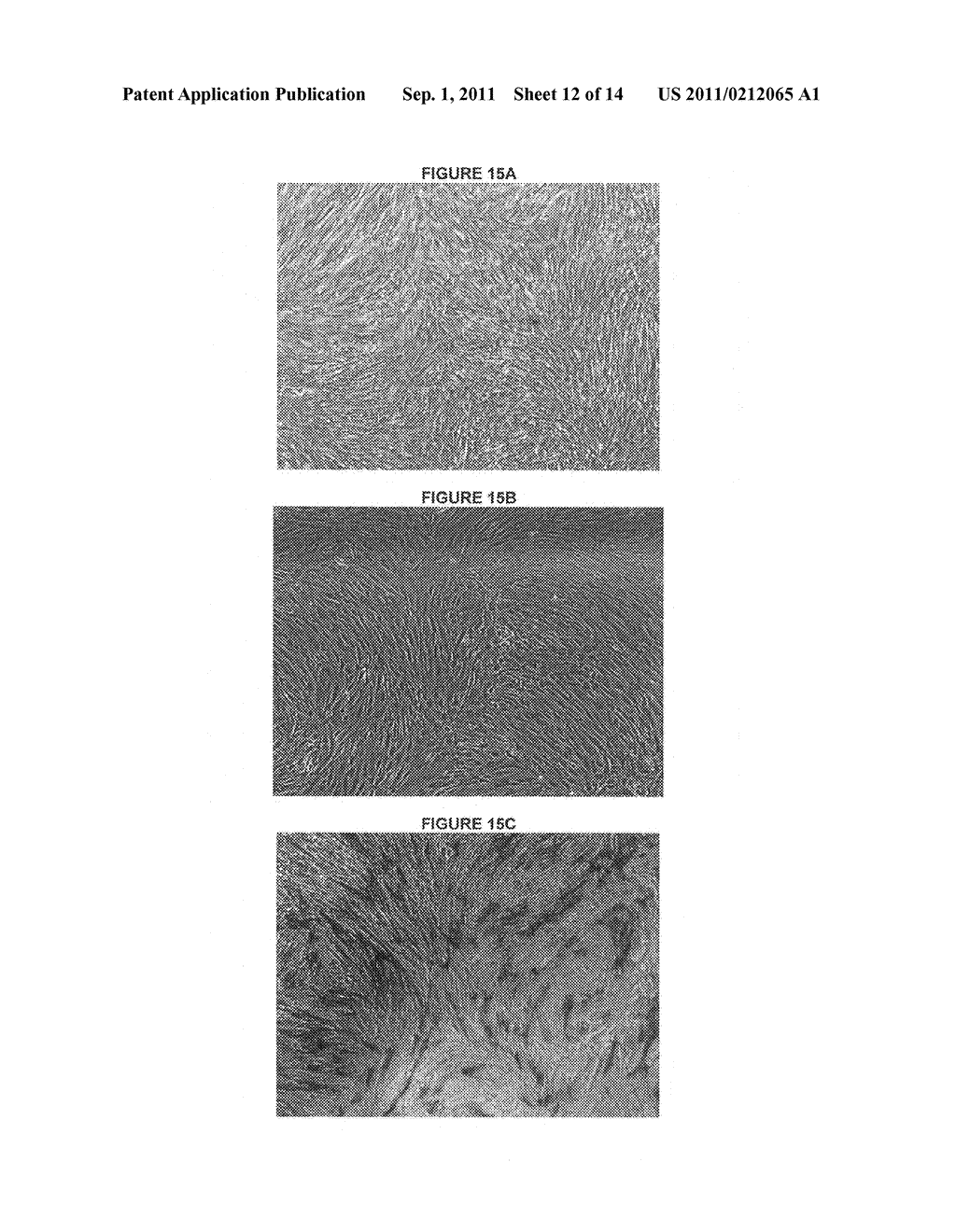 METHODS OF MANUFACTURE OF THERAPEUTIC PRODUCTS COMPRISING VITALIZED     PLACENTAL DISPERSIONS - diagram, schematic, and image 13