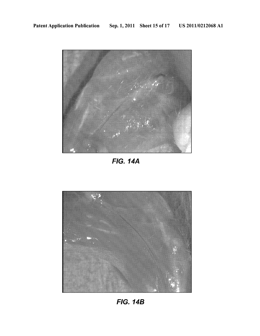 METHODS AND COMPOSITIONS FOR TREATING CONGESTIVE HEART FAILURE - diagram, schematic, and image 16