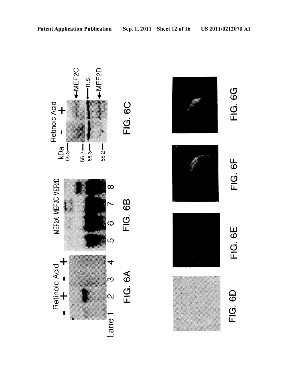 METHODS OF DIFFERENTIATING AND PROTECTING CELLS BY MODULATING THE P38/MEF2     PATHWAY - diagram, schematic, and image 13