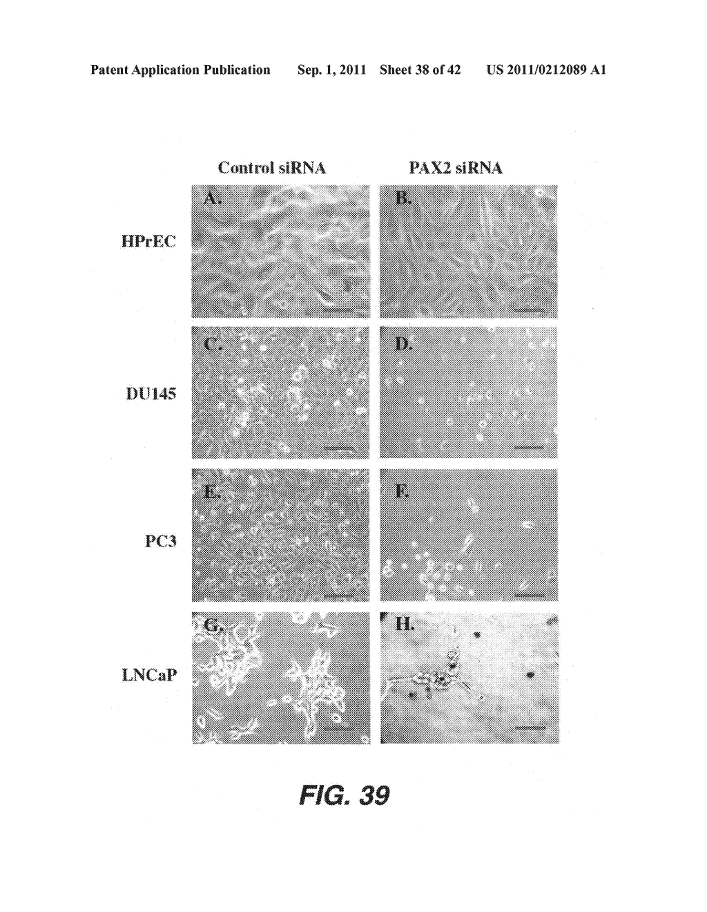 TARGETING PAX2 FOR THE TREATMENT OF BREAST CANCER - diagram, schematic, and image 39