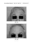 DERMAL DELIVERY diagram and image