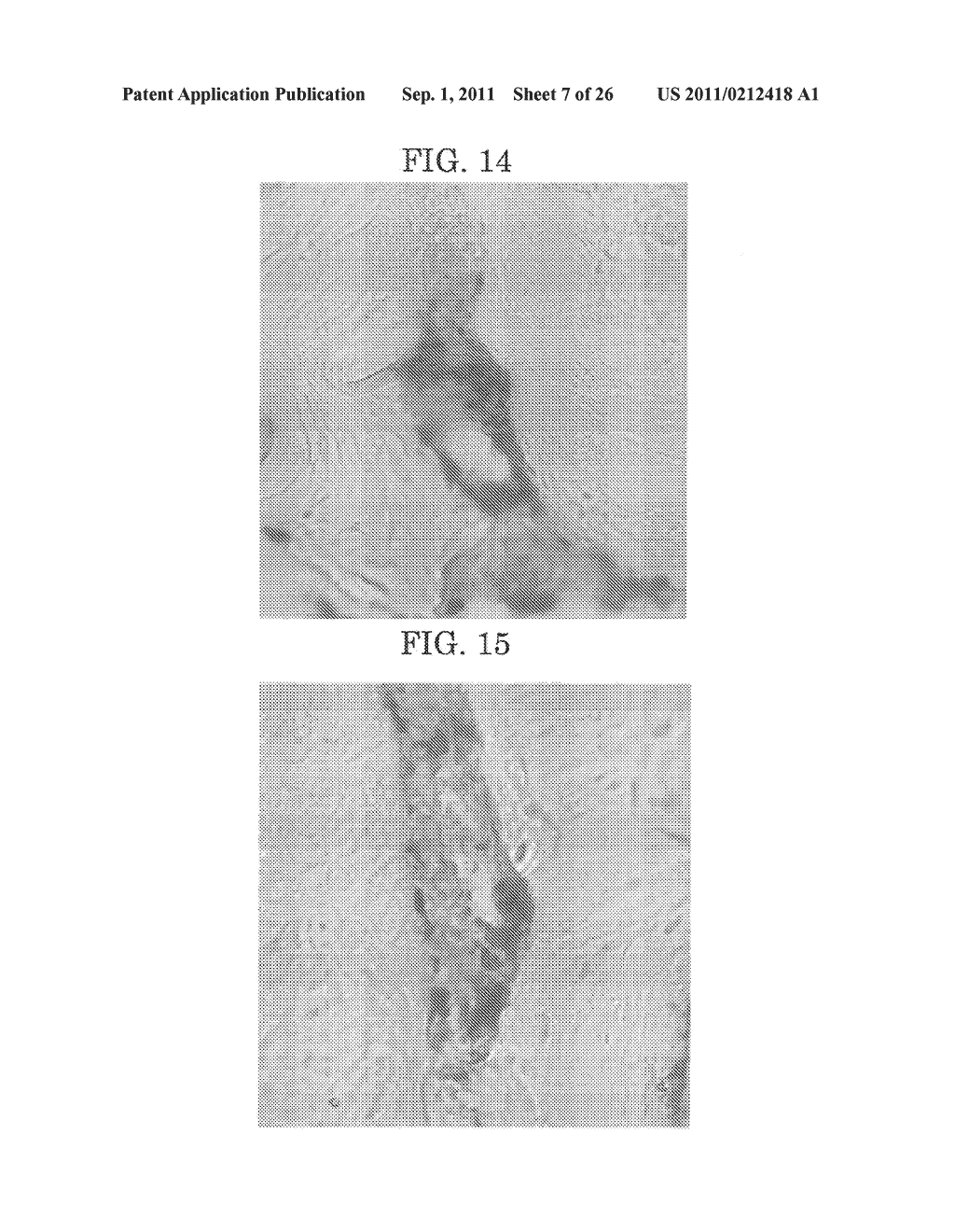 METHODS FOR FORMING TOOTH ROOT AND PERIODONTAL TISSUE UNIT, AND     REGENERATED TOOTH - diagram, schematic, and image 08