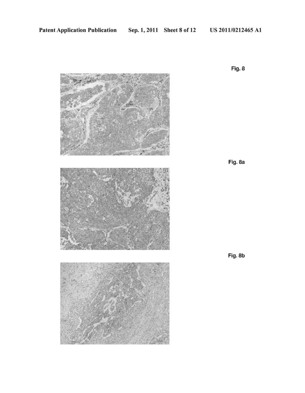 ARMET AS A MARKER FOR CANCER - diagram, schematic, and image 09