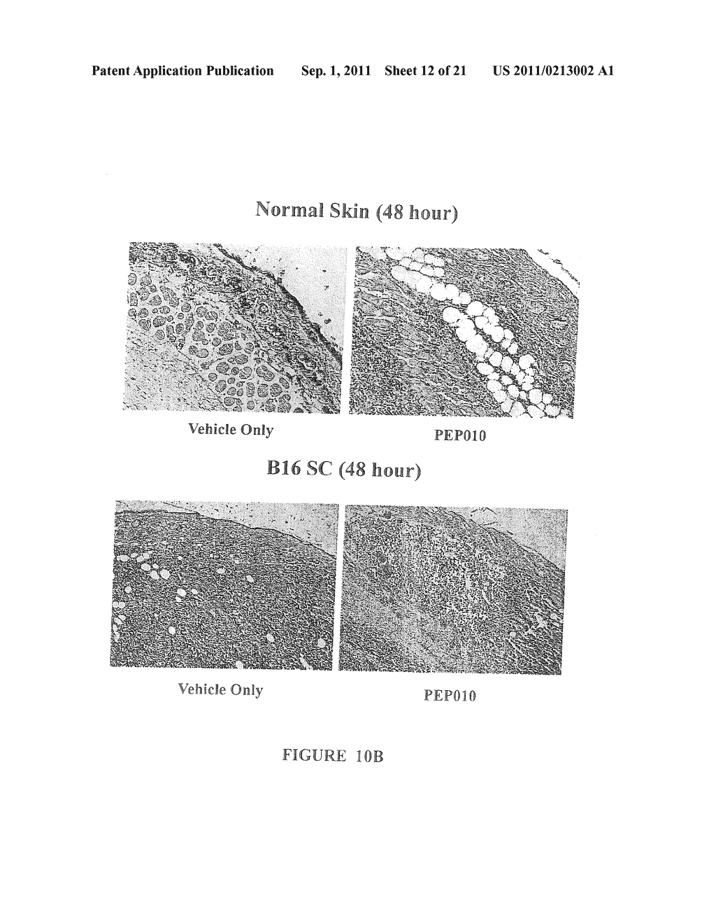 MACROCYCLIC DITERPENES FOR TREATING CONDITIONS ASSOCIATED WITH PROTEIN     KINASE C - diagram, schematic, and image 13