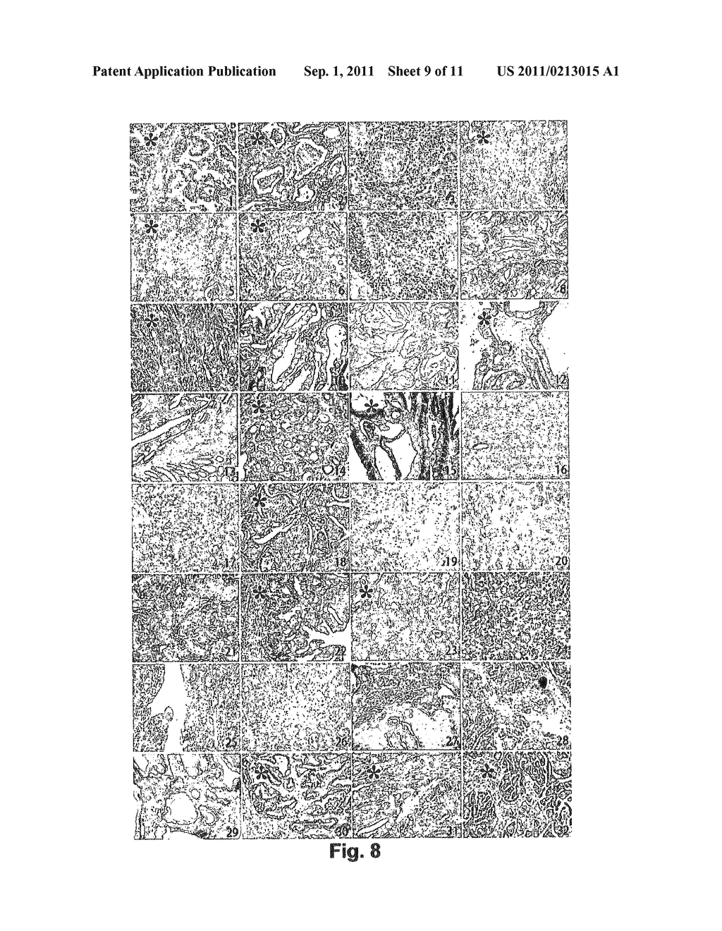 OLIGONUCLEOTIDIC SEQUENCES ABLE TO SILENCE THE EXPRESSION OF THE CYCLIN     D1-TROP2 CHIMERA AND USES THEREOF IN MEDICAL FIELD - diagram, schematic, and image 10